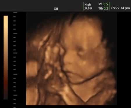 Image - bébé à 17-18 semaines de grossesse