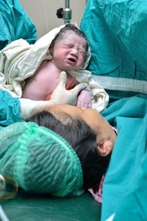 Photo - bébé et maman en salle d'accouchement pour une césarienne