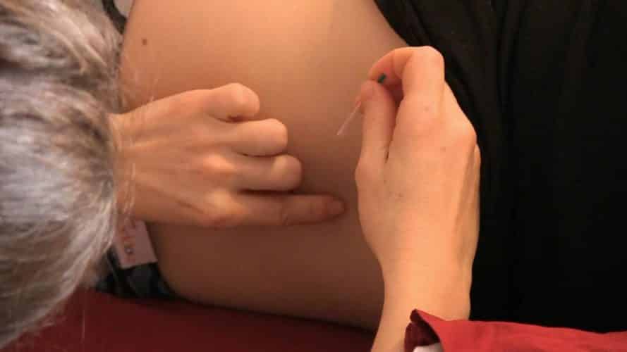Photo - Acupuncture pendant la grossesse