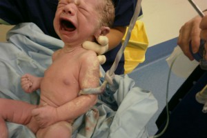 Photo - Cellules souches et sang de cordon - Bébé naissant