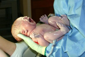 Photo - Cellules souches et sang de cordon - Bébé naissant