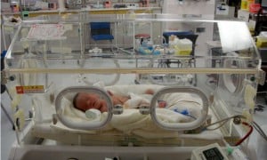 Photo - Bébé prématuré dans un incubateur - La prise de poids chez le nouveau-né