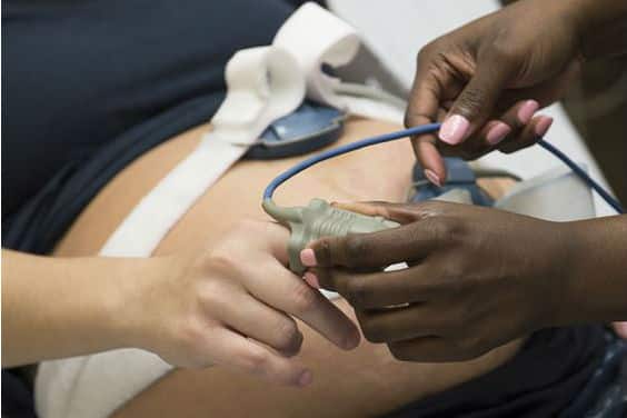 Photo - Femme enceinte avec monitorage - billet La physiologie de la grossesse et de l'accouchement