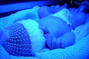 Photo- Bébé prématuré en luminothérapie : Qu'est-ce que la prématurité?